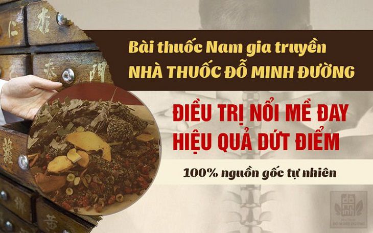 Bài thuốc Mề đay Đỗ Minh chữa dứt điểm mề đay mẩn ngứa