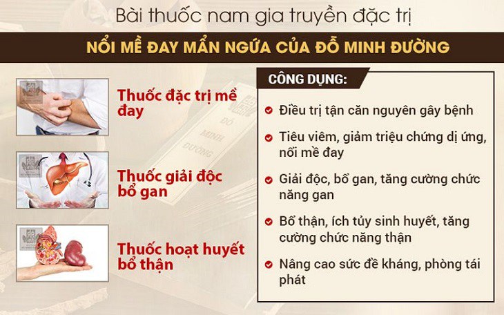 Bài thuốc mề đay Đỗ Minh hiệu quả vượt trội