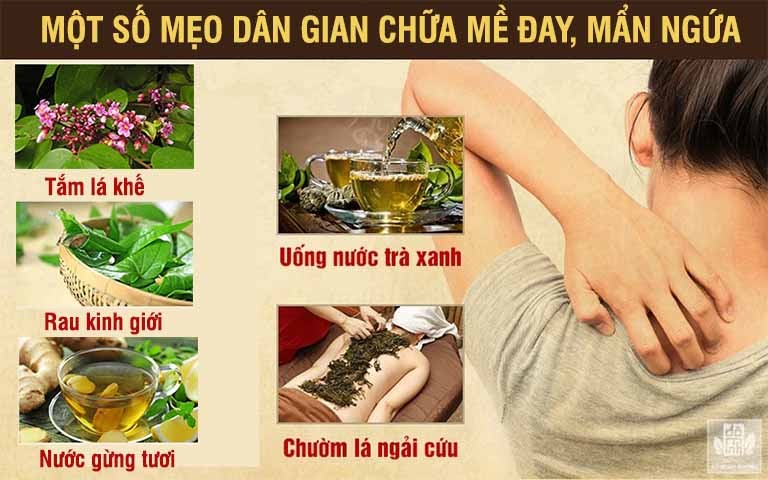 Một số mẹo dân gian chữa mề đay an toàn, hiệu quả