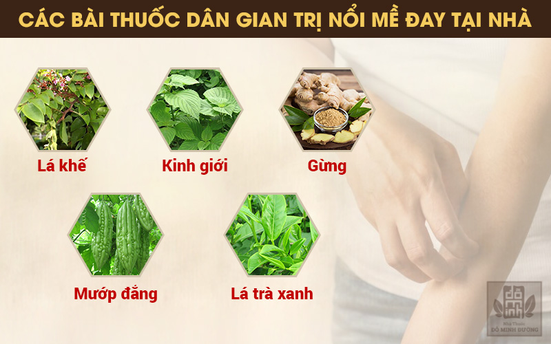 Trị nổi mẩn đỏ tại nhà bằng mẹo dân gian