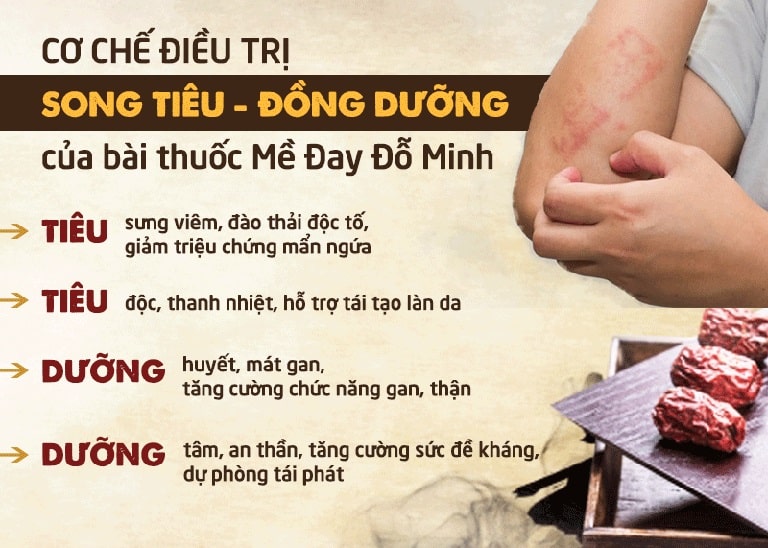 Cơ chế đặc biệt trong bài thuốc Mề đay Đỗ Minh "Song tiêu - Đồng dưỡng"