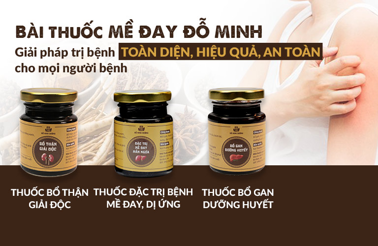 Liệu trình đầy đủ bài thuốc Mề Đay Đỗ Minh