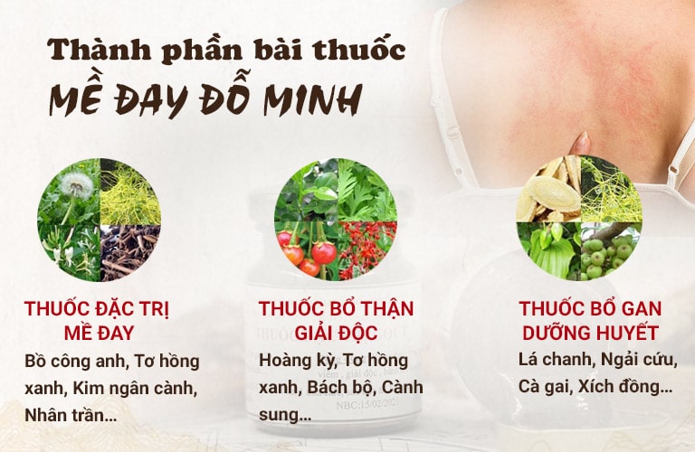 Thành phần bài thuốc Mề đay Đỗ Minh