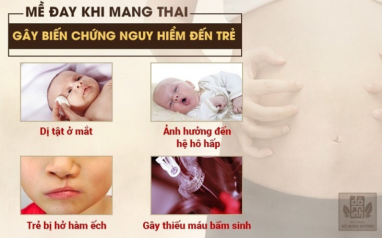 Nổi mề đay khi mang thai tháng cuối có thể gây dị tật ảnh hưởng đến thai nhi