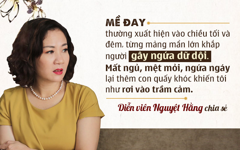 Diễn viên Nguyệt Hằng bị dị ứng nổi mề đay sau sinh