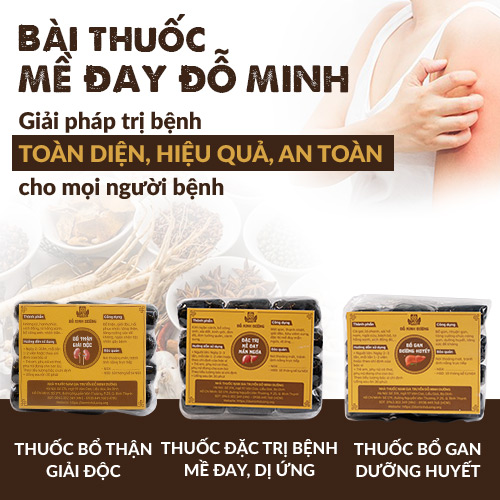 Bài thuốc Mề Đay Đỗ Minh